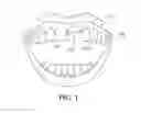Fig. 02 - Immediate and temporary dental prosthesis and methods of utilizing same