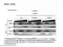 Fig. 49 - RNAI IN BUDDING YEAST