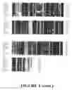 Fig. 06 - Angiogenin Expression in Plants