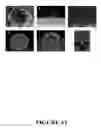 Fig. 45 - Angiogenin Expression in Plants