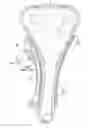 Fig. 01 - Ring-type tensioner
