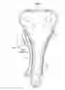 Fig. 02 - Ring-type tensioner
