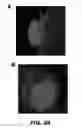 Fig. 43 - Compounds and methods for treating bacterial infections