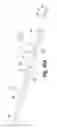 Fig. 09 - Body lumen fluid delivery device