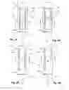 Fig. 02 - Self-contained handheld biopsy needle