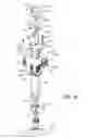 Fig. 35 - Integrated system for cleaning bone and milling the cleaned bone to form bone chips