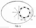 Fig. 06 - Cochlear implant with improved electrode array and controller
