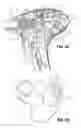 Fig. 08 - Endoscopic surgical clip applier
