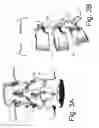 Fig. 04 - DEVICE AND METHOD FOR THE PREVENTION OF MULTI-LEVEL VERTEBRAL EXTENSION