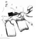Fig. 07 - DEVICE AND METHOD FOR THE PREVENTION OF MULTI-LEVEL VERTEBRAL EXTENSION