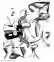 Fig. 08 - DEVICE AND METHOD FOR THE PREVENTION OF MULTI-LEVEL VERTEBRAL EXTENSION
