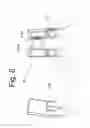 Fig. 09 - DEVICE AND METHOD FOR THE PREVENTION OF MULTI-LEVEL VERTEBRAL EXTENSION