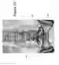 Fig. 28 - DEVICE AND METHOD FOR THE PREVENTION OF MULTI-LEVEL VERTEBRAL EXTENSION