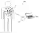 Fig. 01 - Determination of cardiac resynchronization therapy settings