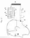 Fig. 02 - Adjustable Polarity Laser Device and Polarized Low-Level Laser Therapy Method