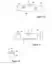 Fig. 08 - Prosthesis delivery system