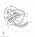 Fig. 04 - Methods and apparatus for atrioventricular valve repair