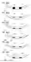 Fig. 49 - MASKED INTRAOCULAR IMPLANTS AND LENSES