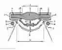 Fig. 01 - Accommodative intraocular lens driven by ciliary mass