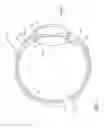 Fig. 02 - Intraocular lens