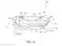 Fig. 33 - Intraocular lens