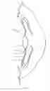 Fig. 02 - Biased accommodating intraocular lens
