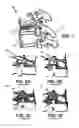 Fig. 02 - Apparatus and methods for vertebral augmentation using linked expandable bodies