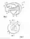 Fig. 02 - Extended articular surface resurfacing head