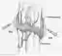 Fig. 01 - Methods and compositions to enhance bone growth comprising a statin