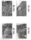 Fig. 05 - ADIPOSE TISSUE MATRICES