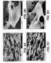 Fig. 06 - ADIPOSE TISSUE MATRICES
