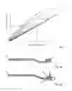 Fig. 02 - Toothbrush tracking system