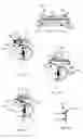 Fig. 05 - Method and apparatus for diverting sweat, liquid, moisture, or the like from an eye