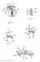 Fig. 06 - Method and apparatus for diverting sweat, liquid, moisture, or the like from an eye
