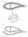 Fig. 01 - METHOD AND MOULD FOR MOULDING A WIND TURBINE BLADE