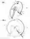 Fig. 02 - Hosiery manipulation apparatus