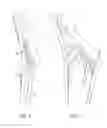 Fig. 03 - Folding chair