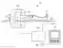 Fig. 01 - Method and magnetic resonance system for distortion correction in magnetic resonance imaging