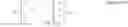 Fig. 02 - Method and apparatus of recovering backhaul link failure between base station and relay node
