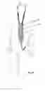 Fig. 08 - SHEATH TO MASK ELECTRICAL CONDUCTOR