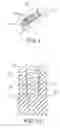 Fig. 02 - Universal sterilizing tool