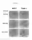 Fig. 09 - Compositions and Methods for Treating and Diagnosing Cancer