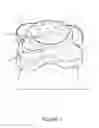Fig. 02 - ADJUSTABLE ORTHODONTIC BRACKET