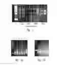 Fig. 02 - Gene expression profiling from FFPE samples