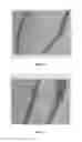 Fig. 04 - BMP-2 Upregulating Compounds For Healing Bone Tissue And Screening Methods For Selecting Such Compounds