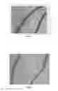 Fig. 05 - BMP-2 Upregulating Compounds For Healing Bone Tissue And Screening Methods For Selecting Such Compounds
