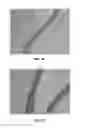 Fig. 19 - BMP-2 Upregulating Compounds For Healing Bone Tissue And Screening Methods For Selecting Such Compounds