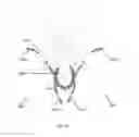 Fig. 07 - Bodily implants and methods of treating fecal incontinence using bodily implants