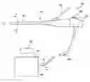 Fig. 01 - EXTENDED SPECTRAL SENSITIVITY ENDOSCOPE SYSTEM AND METHOD OF USING THE SAME