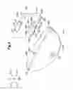Fig. 06 - Battery pack encasing structure and walking assistance device using same